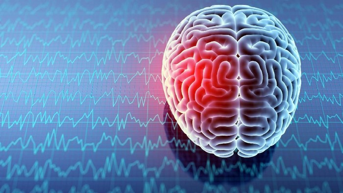 Geger Penyakit Otak Misterius Serang Warga Kanada, Dokter Dibuat Bingung